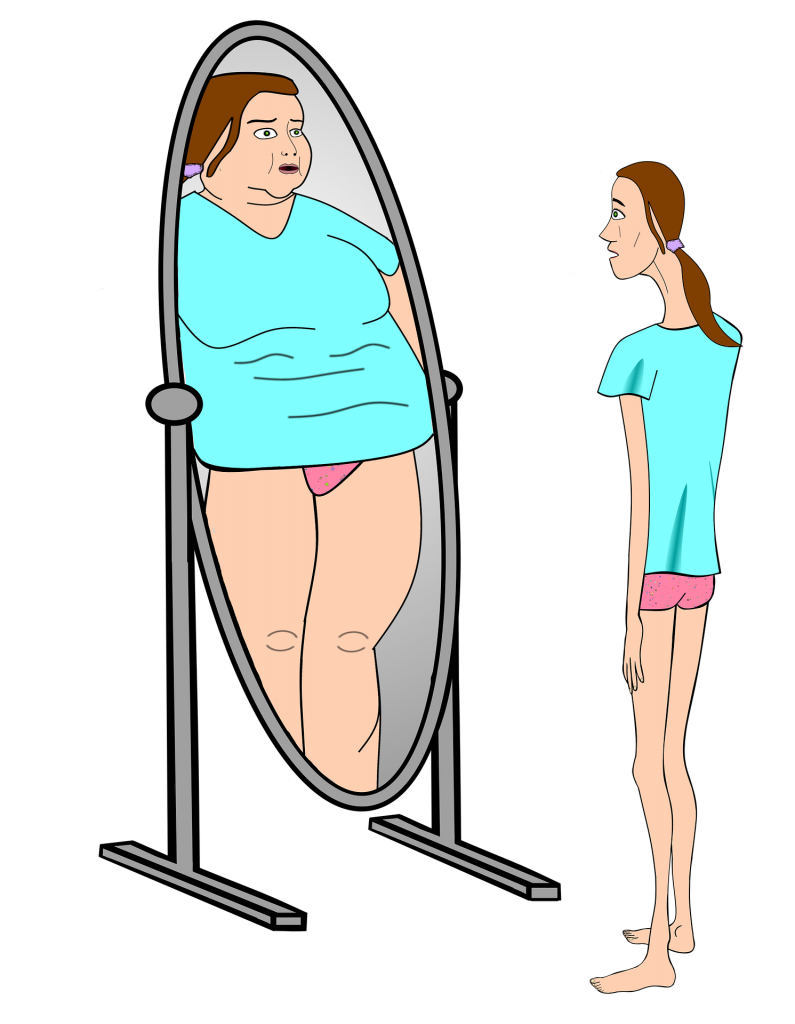 Anorexia y bulimia, son enfermedades con alto índice de mortalidad: UNAM